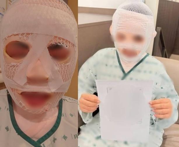 잠든 여친 얼굴에 끓는 물 부은 한국 남성…"딴 남자 못 만나게 하려고"