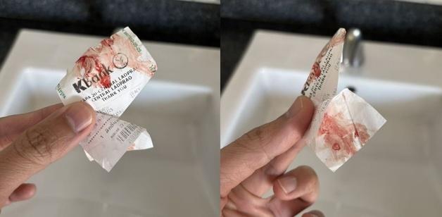 "지하철서 모르는 사람이 팔에 피 묻히고 도망"…병 옮기려 했나?