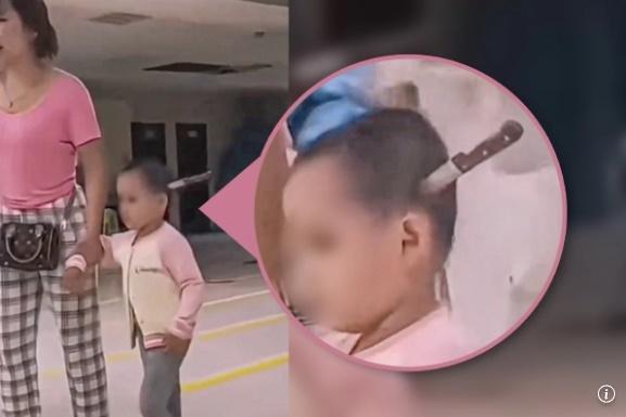 "보기만 해도 섬뜩"…머리에 칼 꽂힌 아이, 손잡고 걸어서 병원 간 엄마