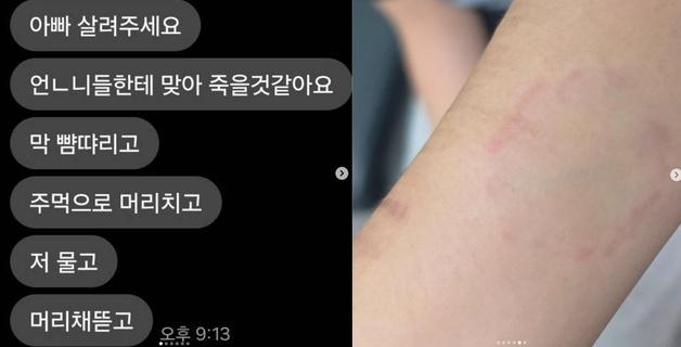 "언니들이 바지 벗기고 머리채 뜯어…저 살려주세요" 대안학교 간 딸 절규