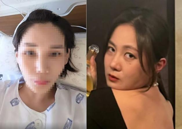 "머리 10㎝ 찢어지고 피 흥건, 뵈는 게 없다" 박나래 '주사 이모' 무슨 일?